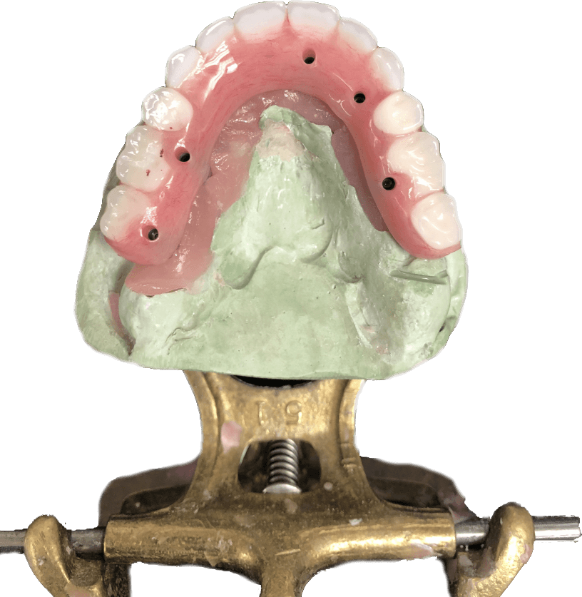 SCREW RETAINED HYBRID