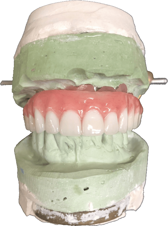 SCREW RETAINED HYBRID