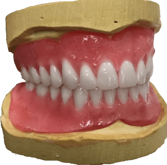 SET UP/WAX UP FOR TRY IN