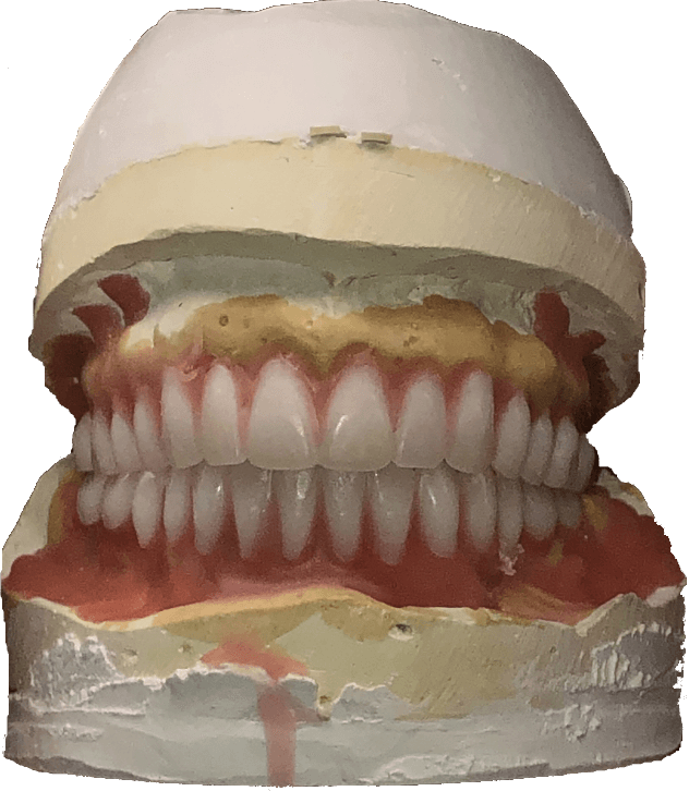UPPER AND LOWER IMMEDIATE SET UP